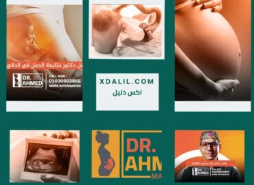 دكتور احمد محمود لأمراض النساء والتوليد والحقن المجهري