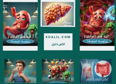 دكتور احمد خطاب جهاز هضمي ومناظير