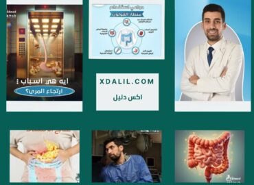 دكتور احمد خطاب جهاز هضمي ومناظير