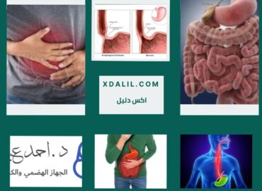 دكتور احمد عبده يوسف