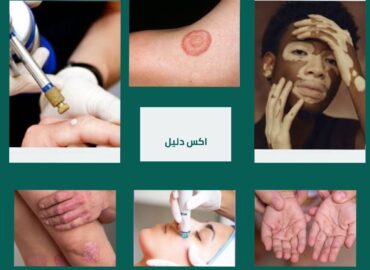 دكتور عمر شعيب أخصائي الأمراض الجلدية والتناسليه