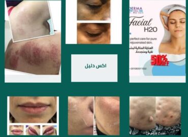 عيادة ديرما دكتورة مي زين