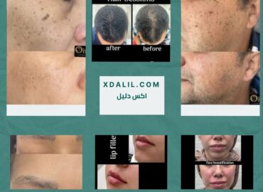 الدكتوره أمنية العبد أخصائى جلديه و تجميل و ليزر