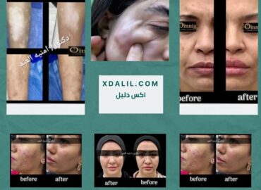 الدكتوره أمنية العبد أخصائى جلديه و تجميل و ليزر